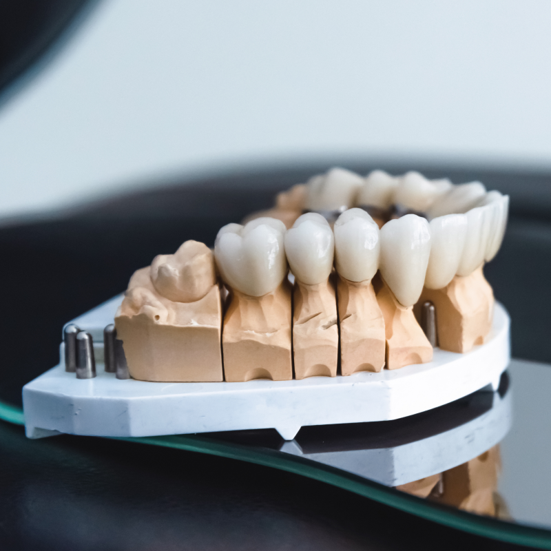 Implantes dentales de zirconio