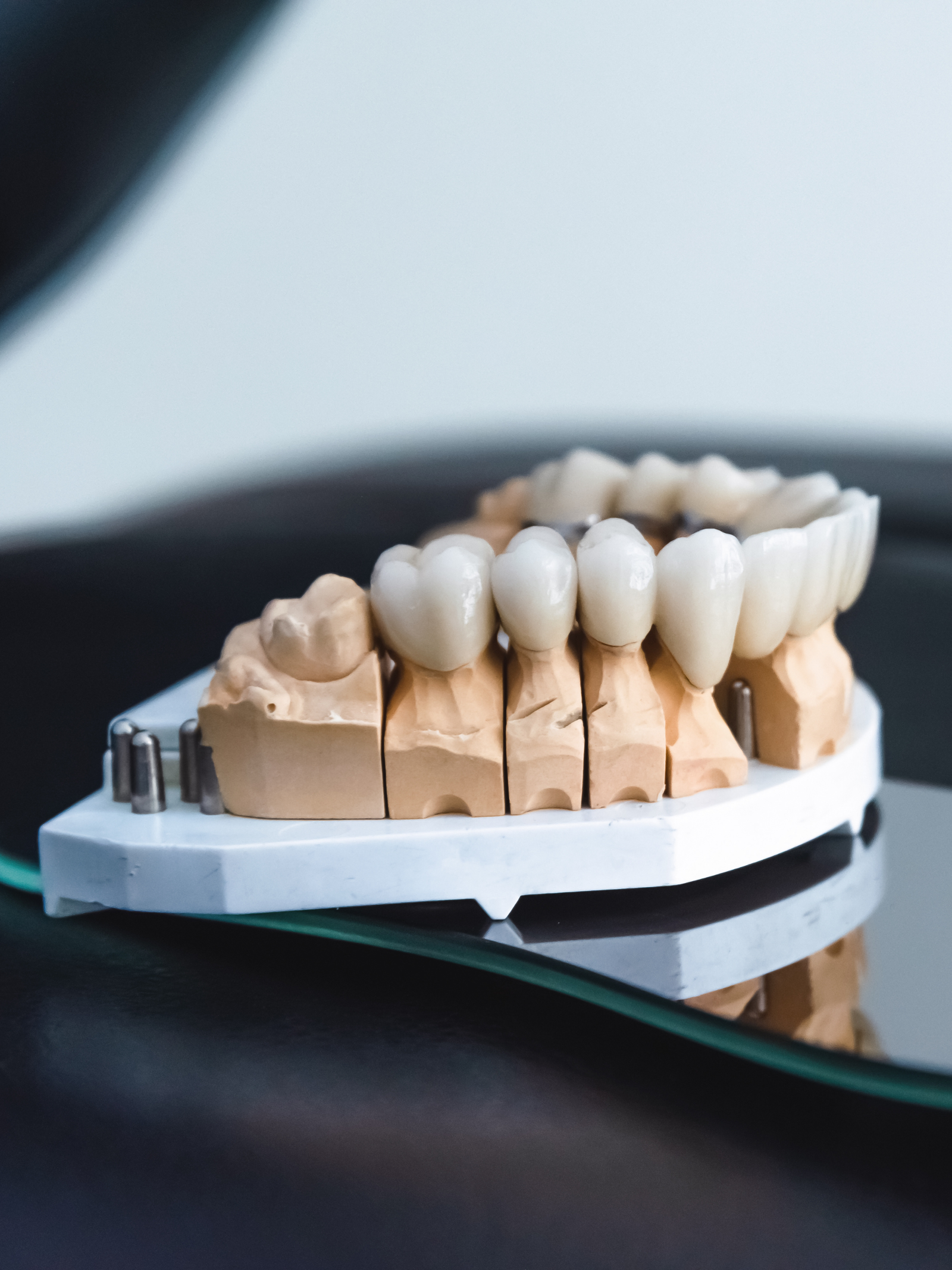 Implantes dentales de zirconio