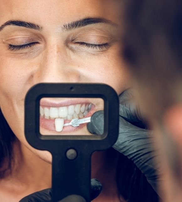 estetica-dental-en-valencia-dentista-biologico