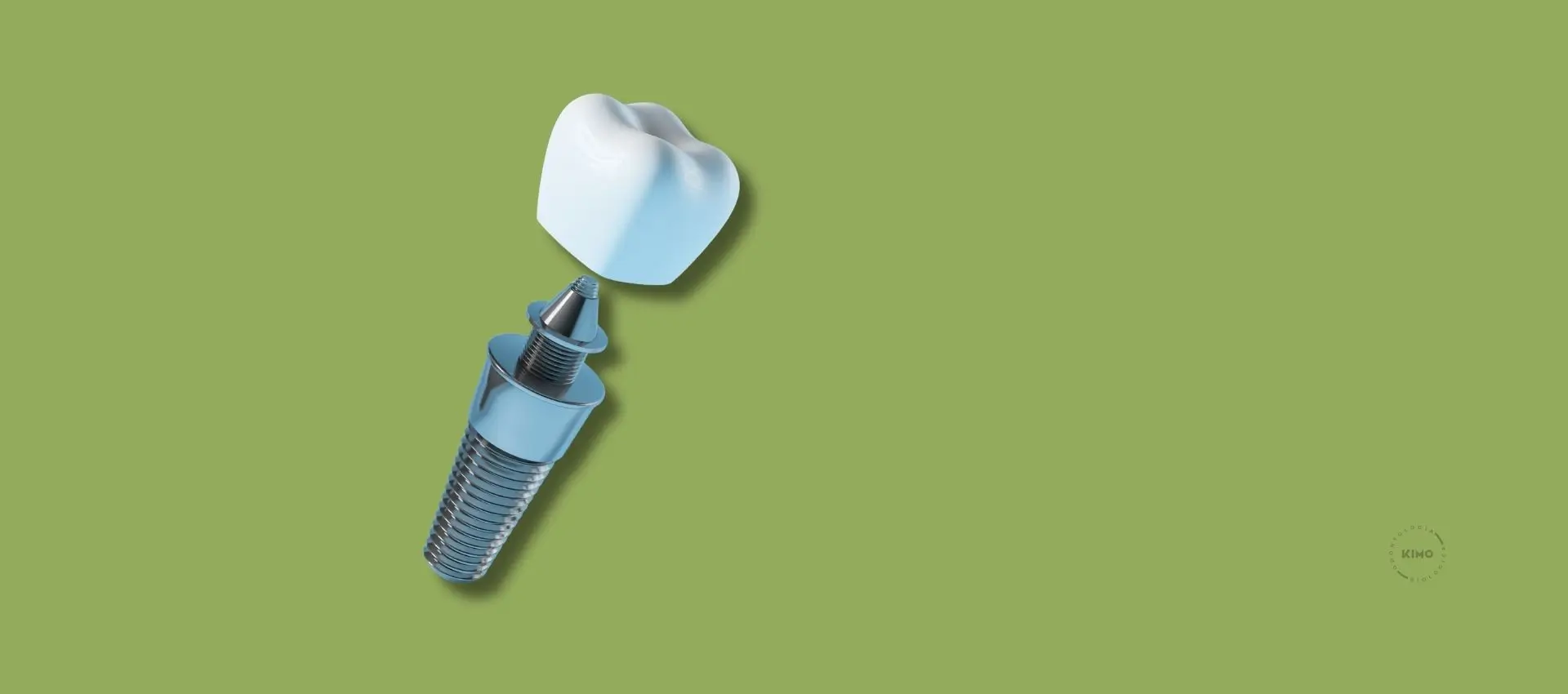 Implante inmediato tras extracción en Kimo en Valencia