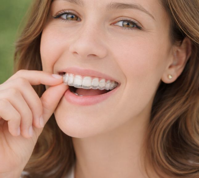 Ortodoncia invisible para adultos