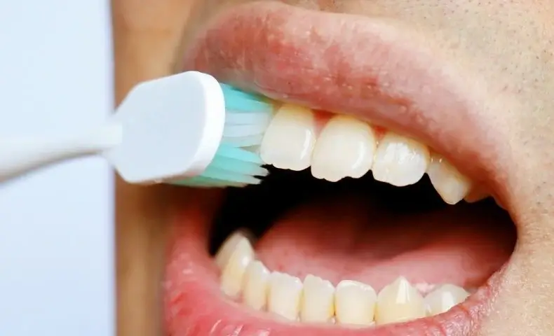 Problemas estéticos que afectan a los dientes delanteros