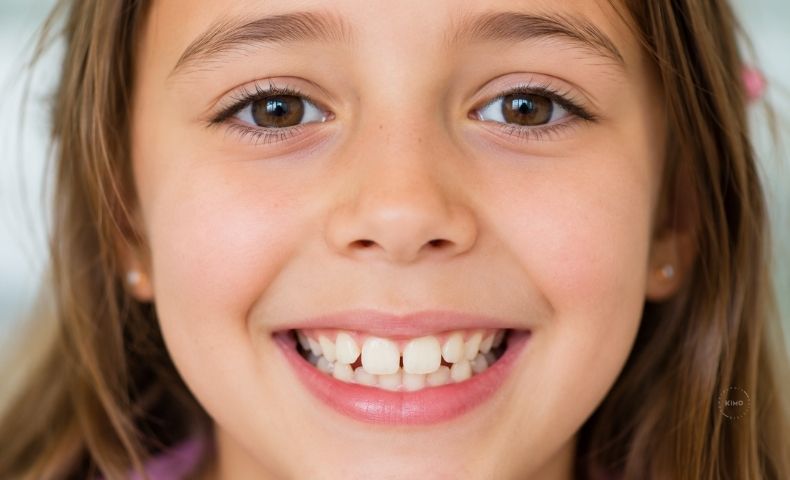Dientes torcidos en niños pequeños
